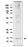 Rfa3/Rpa3 | Replication factor A protein 3 (Saccharomyces cerevisiae)  in the group Antibodies Other Species / Fungi at Agrisera AB (Antibodies for research) (AS21 4551)